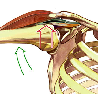 Rotator cuff tendonitis | Dr Brian Cable M.D. | Dr Brian Cable MD